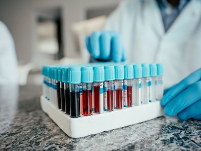Article featured image