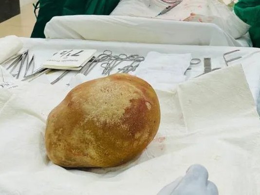 Article featured image