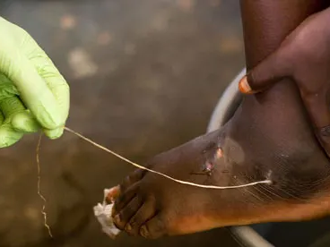 Article featured image