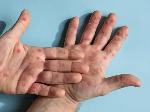 Article featured image