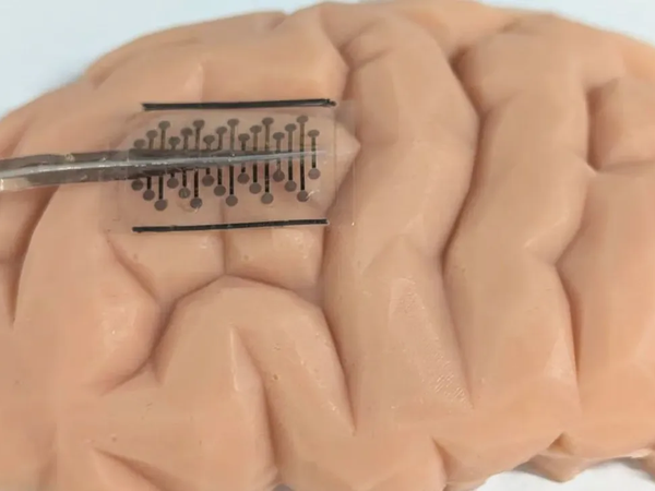 Article featured image