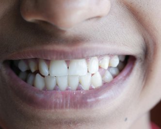 Article featured image