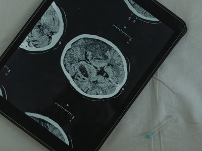 Article featured image