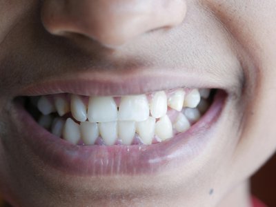 Article featured image
