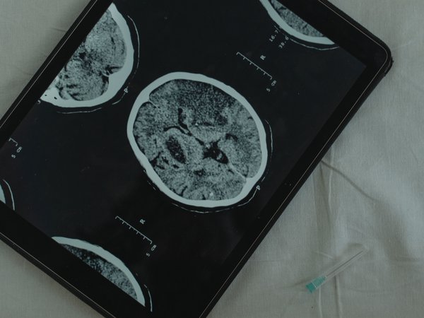 Article featured image