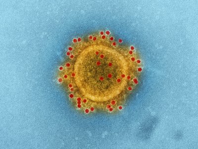 Article featured image