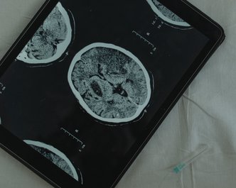 Article featured image