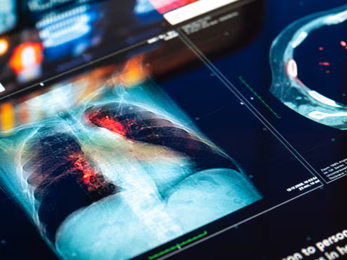 Article featured image