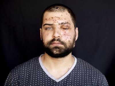 Article featured image