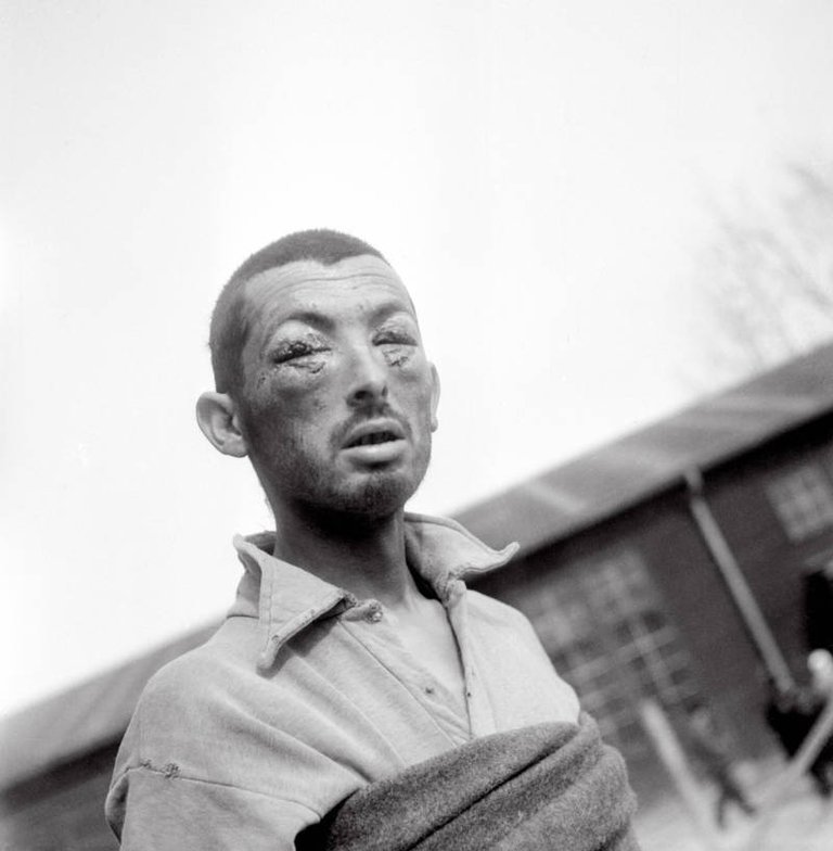 A tortured prisoner of the Buchenwald concentration camp in April 1945..jpg