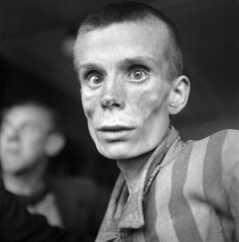 An 18-year-old Russian prisoner of Dachau concentration camp not long after its liberation by U.S. forces on April 29, 1945..jpg