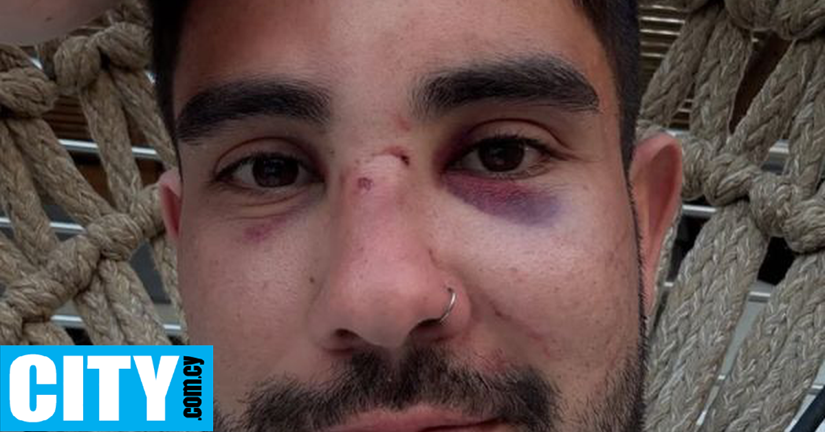 «Ποτέ δεν θα μας κάνετε να σωπάσουμε»: Ομοφοβική επίθεση δέχτηκε τουρίστας στη Ρόδο