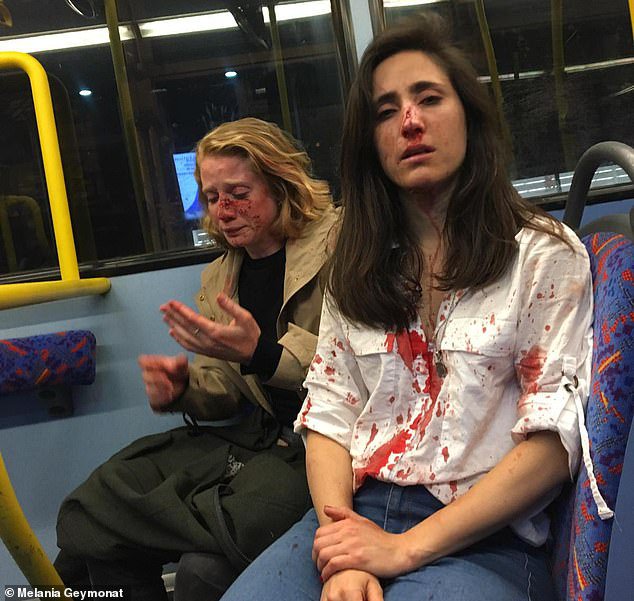 Horrifying-picture-shows-lesbian-couple-covered-in-blood-after-gang.jpg