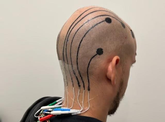 Researchers-use-temporary-scalp-tattoo-to-track-brainwaves.jpg