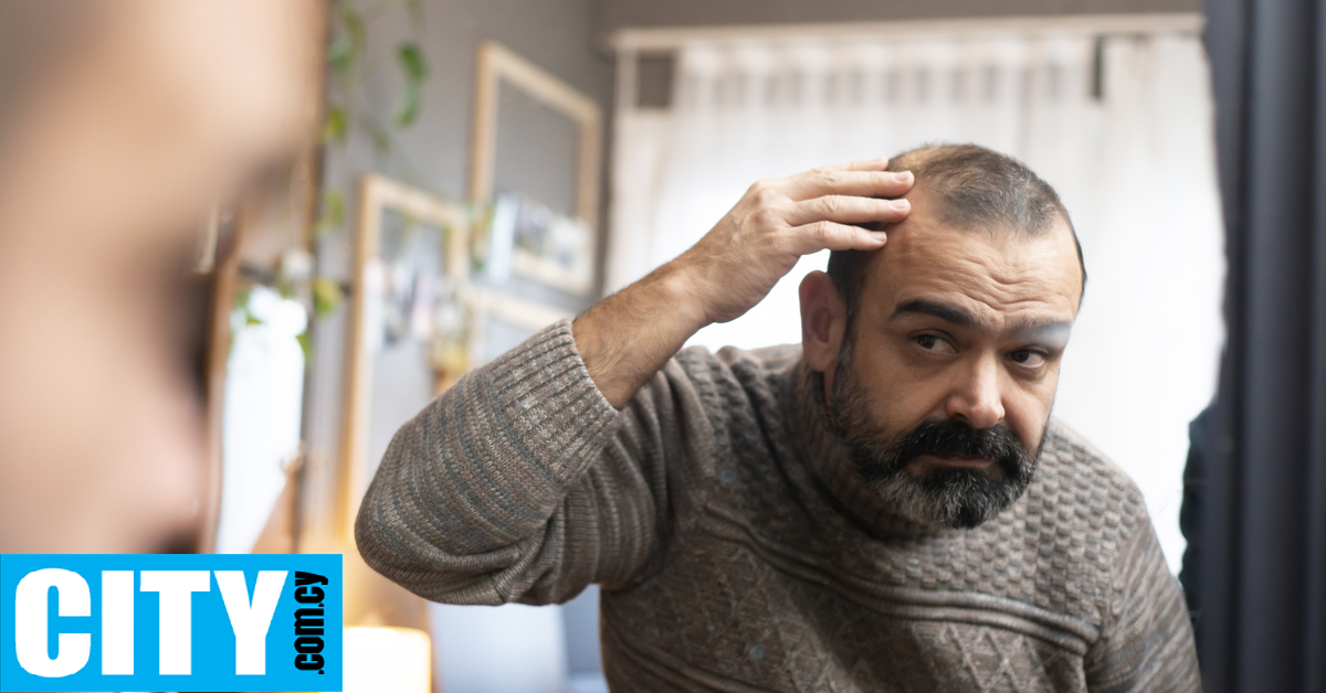 Η ανακάλυψη που, ίσως, αλλάζει τα δεδομένα για την αντιμετώπιση της φαλάκρας