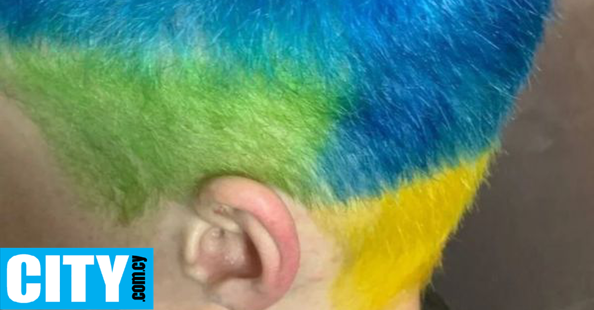 Επέβαλαν πρόστιμο σε 25χρονο Ρώσο τρανς επειδή έβαψε τα μαλλιά του στα χρώματα της Ουκρανίας