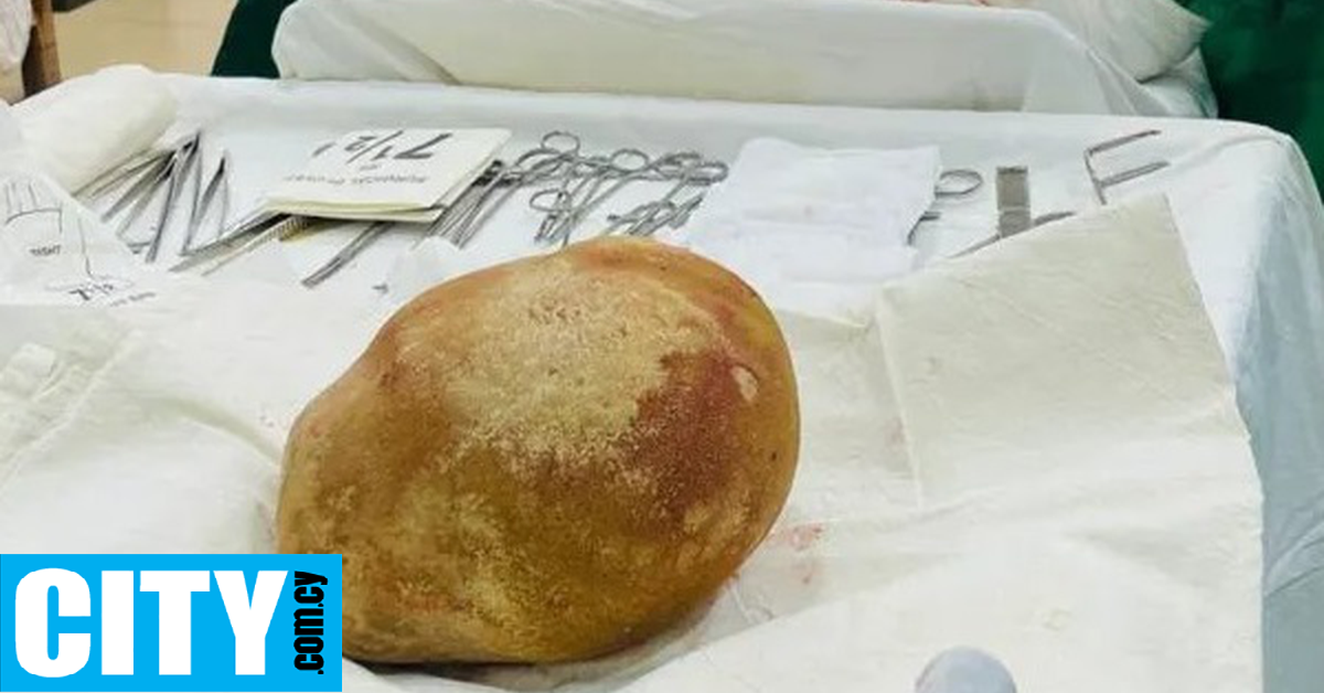 &Gamma;&iota;&alpha;&tau;&rho;&omicron;ί &alpha;&phi;&alpha;ί&rho;&epsilon;&sigma;&alpha;&nu; &pi;έ&tau;&rho;&alpha; 3,1 &kappa;&iota;&lambda;ώ&nu; &alpha;&pi;ό &tau;&eta;&nu; &omicron;&upsilon;&rho;&omicron;&delta;ό&chi;&omicron; &kappa;ύ&sigma;&tau;&eta; &epsilon;&nu;ό&sigmaf; ά&nu;&delta;&rho;&alpha;
