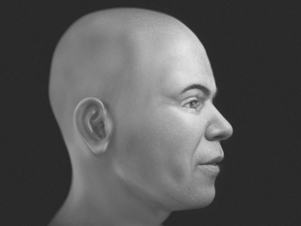 skynews-racesa-vampire-facial-reconstruction_7154013.jpg