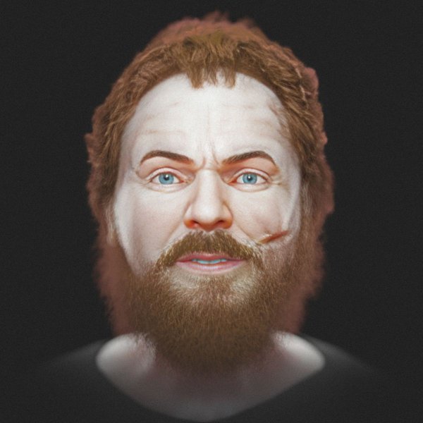 skynews-racesa-vampire-facial-reconstruction_7154014.jpg