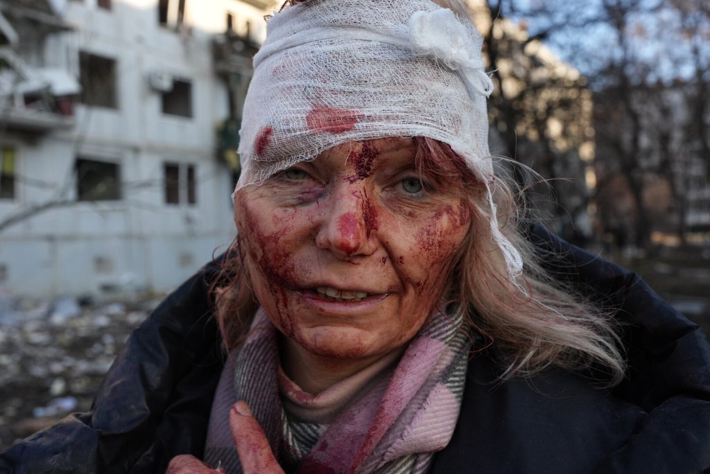 ukraine-wounded-woman.jpg